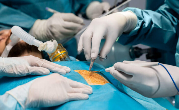 Bariatric and Laparoscopic Surgery